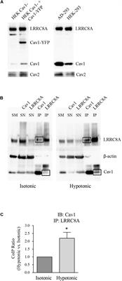 Functional Interaction Between Caveolin 1 and LRRC8-Mediated Volume-Regulated Anion Channel
